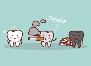 sbiancamento-denti-airflow--immagine-2